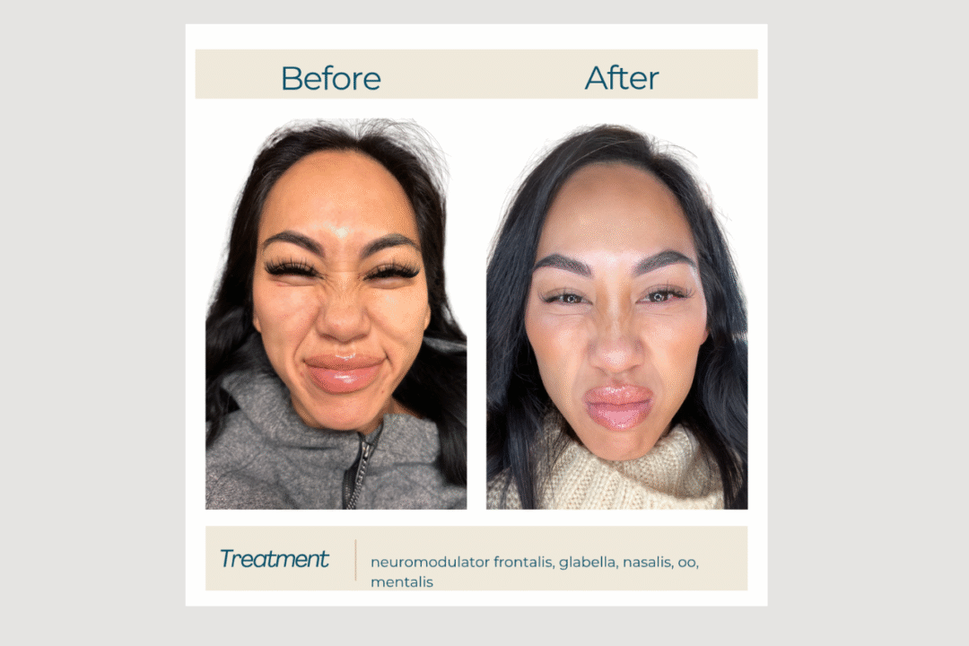 Full-Face Tox