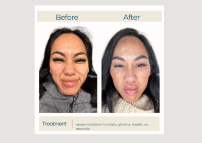 Full-Face Tox