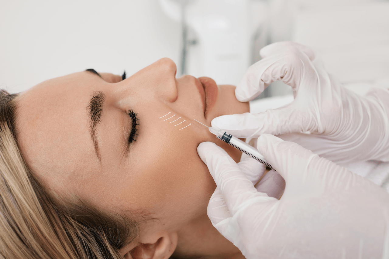 dermal fillers and facial balancing