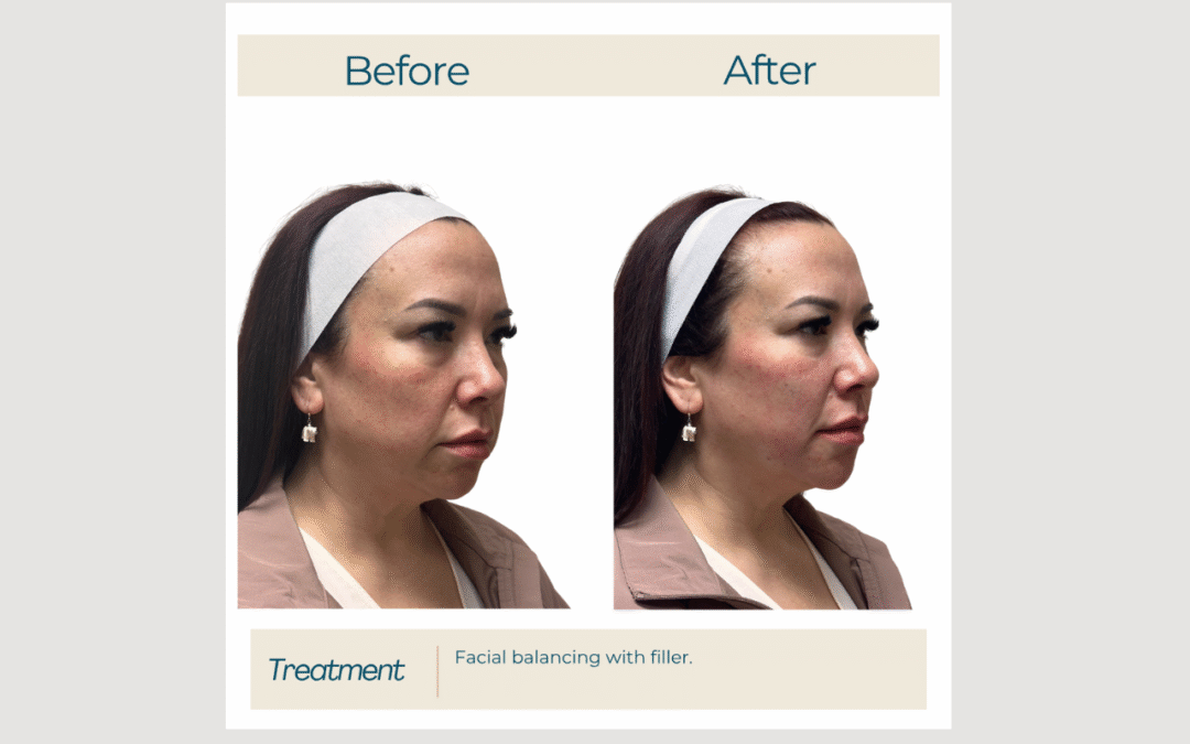 Restore, Refine, and Rejuvenate