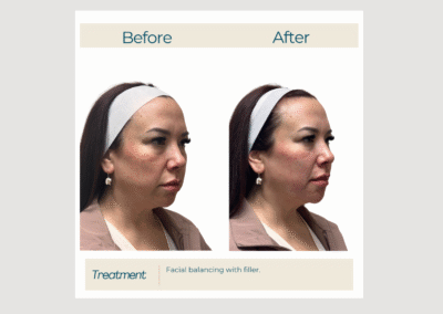 Restore, Refine, and Rejuvenate