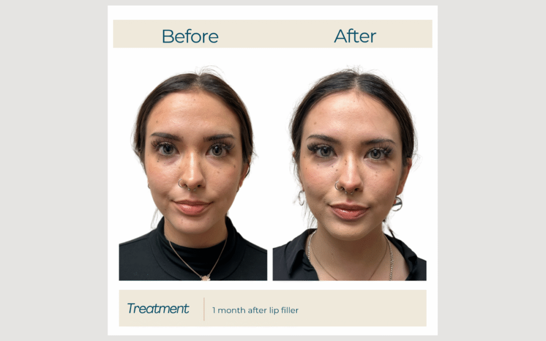 Filler for Natural Balance