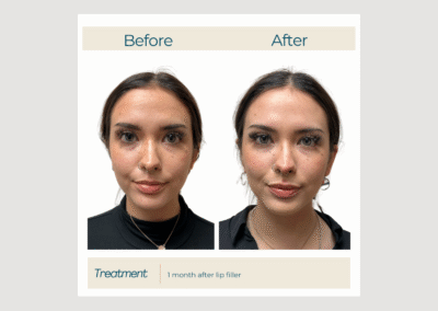 Filler for Natural Balance