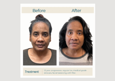 Smoother, More Even Skin
