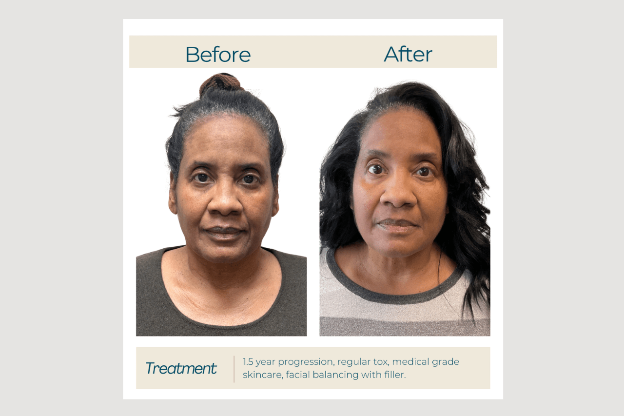 medical grade skin care zo skin health products at new age medspa in anchorage alaska