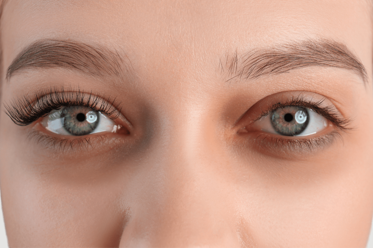 under eye treatment at new age medspa in anchorage alaska with ezgel