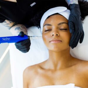 Skin Pen Microneeding Treatment in Anchorage at New Age Medspa