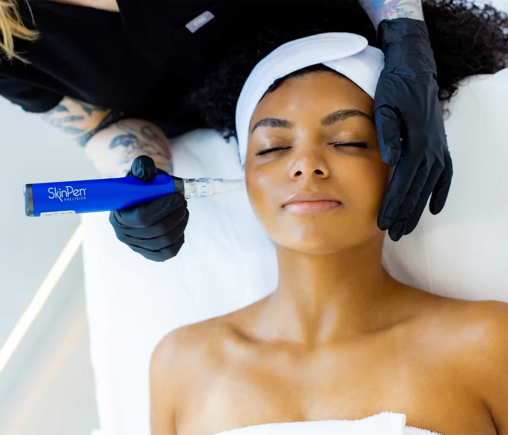 Skin Pen Microneeding Treatment in Anchorage at New Age Medspa