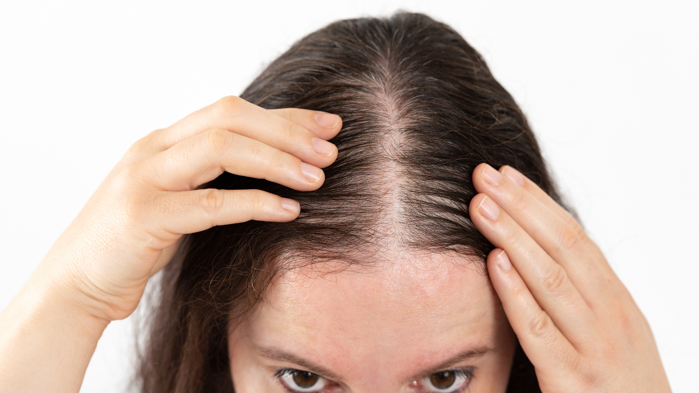 Cynosure Ultra Laser: The Technology Behind Hair Restoration in Anchorage