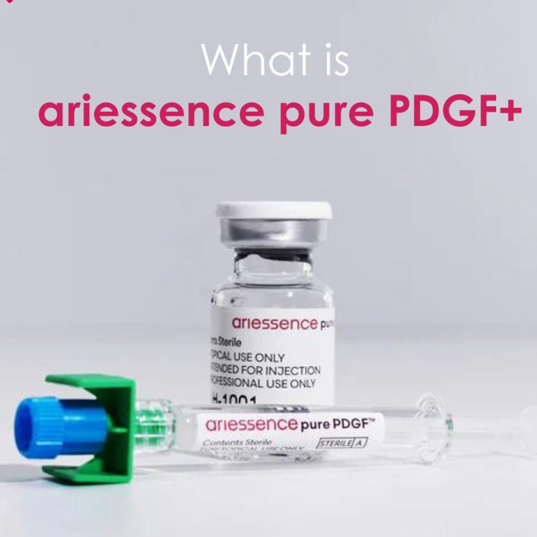 pdgf anchorage pdgf