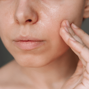 rf microneedling at new age medspa in anchorage ak