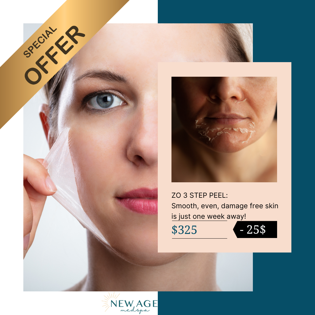 chemical peel chemical peel special at new age medspa in anchorage ak