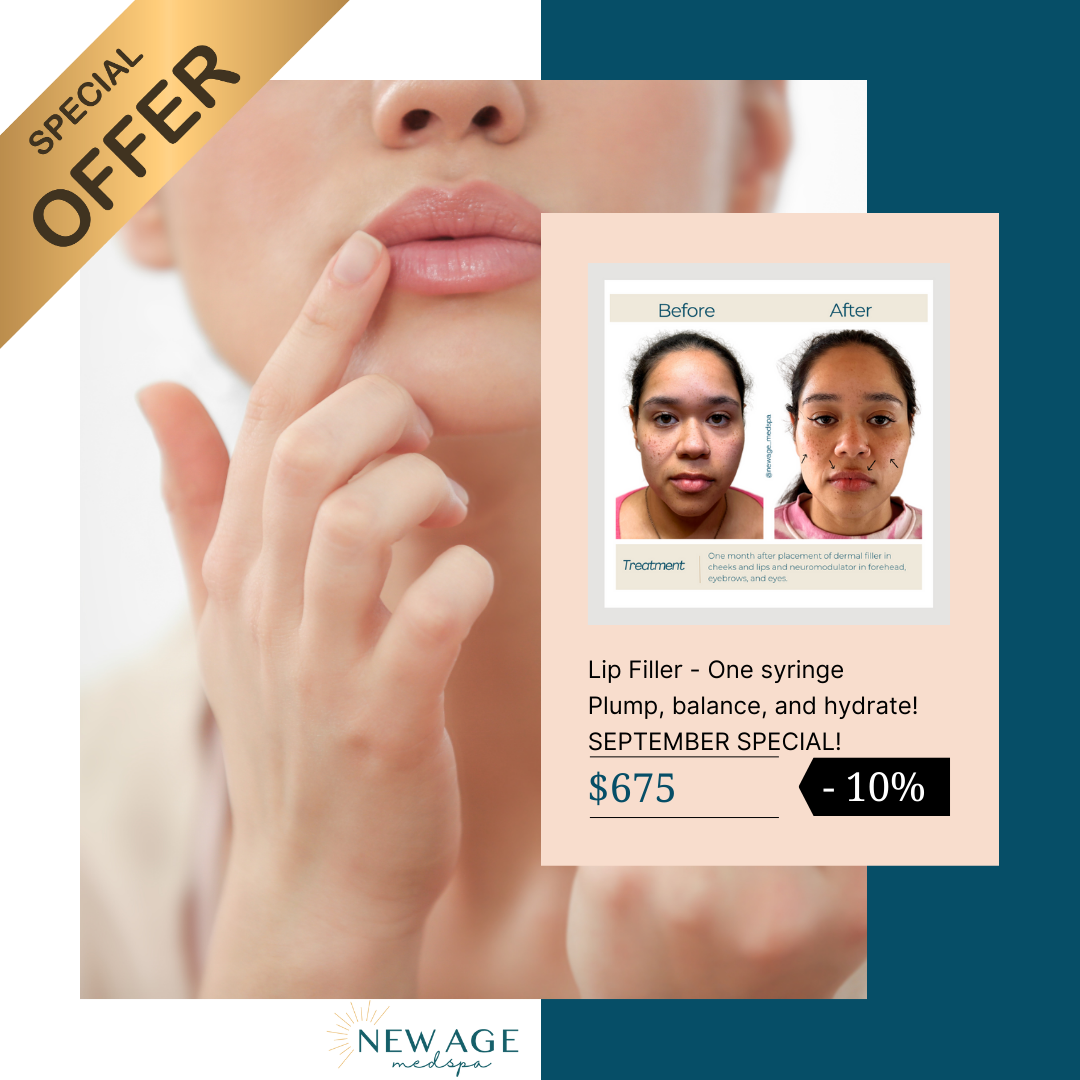 lip lip filler special at new age medspa anchorage ak lip filler special at new age medspa anchorage ak