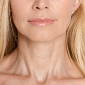 ultra lase md face and neck skin treatment in anchorage ak at new age medspa