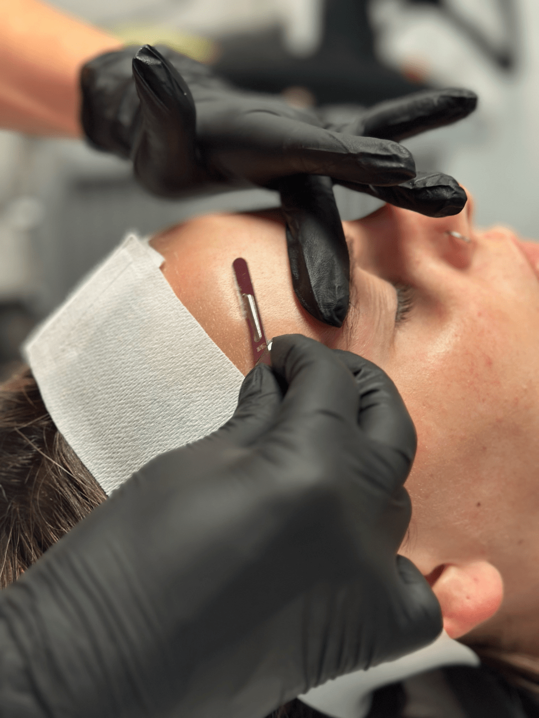 Dermaplaning treatment at New Age Medspa Anchorage Alaska