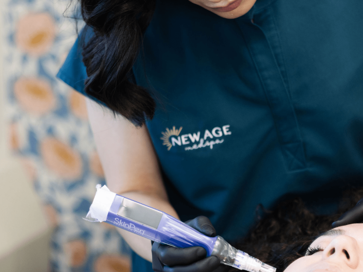Patricia Quepons performing SkinPen microneedling at New Age Medspa
